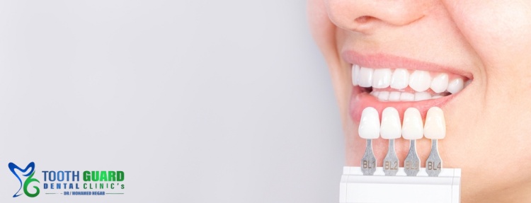 Hollywood Smile price 2025